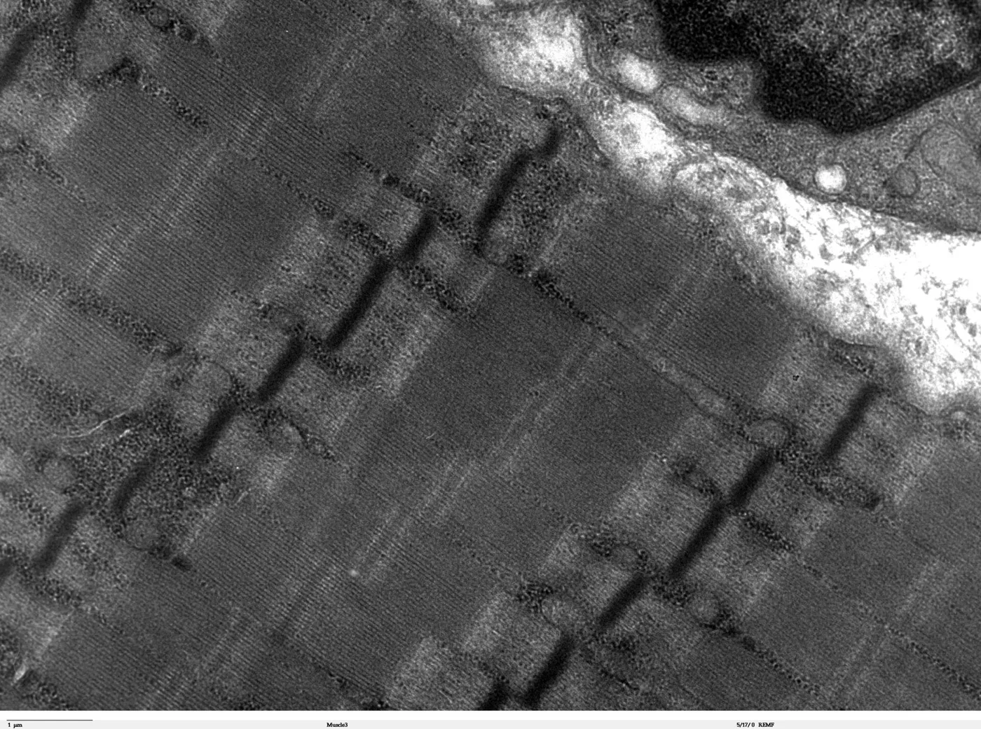 Micrografía electrónica de músculo esquelético humano: se distinguen miofibrillas y bandas de los sarcómeros.